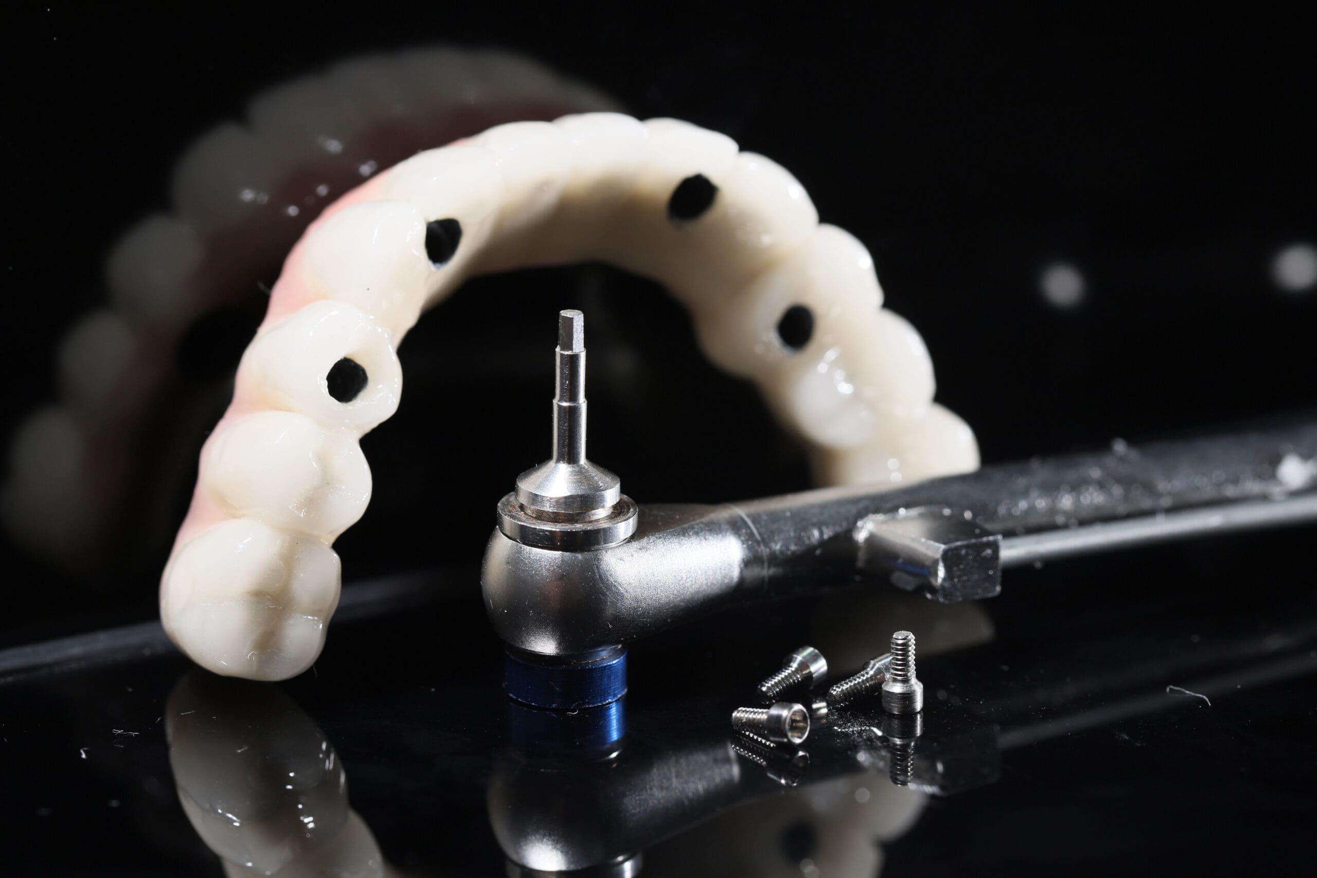 All-On-X Dental Implants